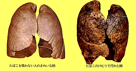 ニコチン入りの電子タバコと比べてどうですか?