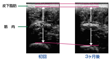 貯筋運動ステーションによる皮下脂肪と筋肉の変化